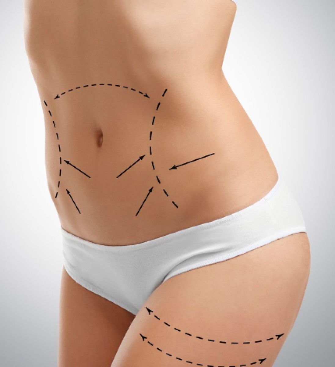 Body Contouring