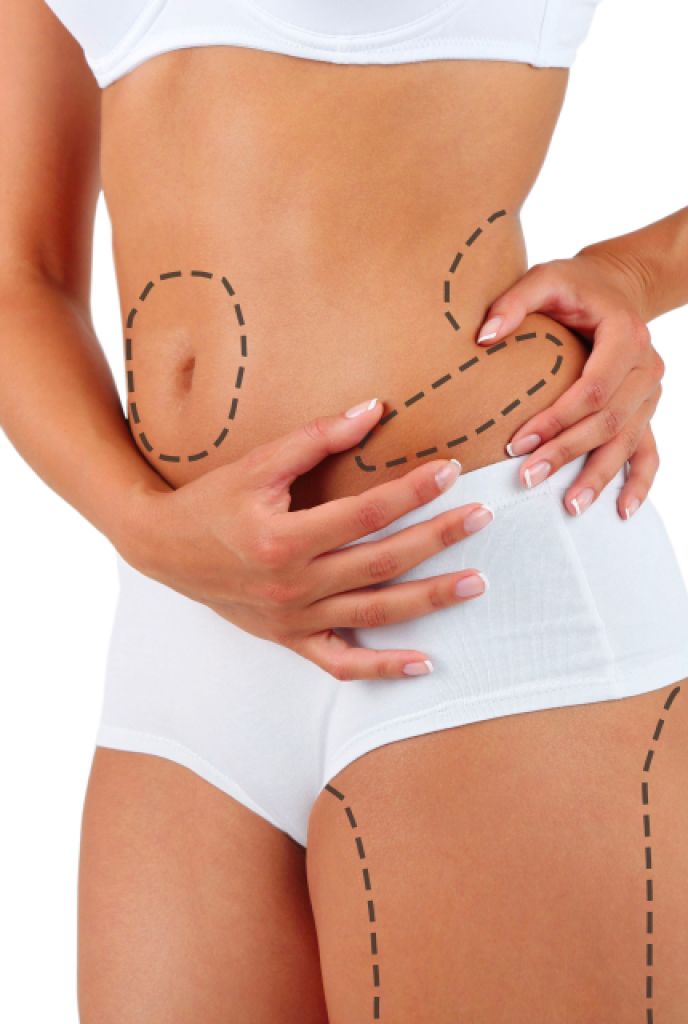 Liposuction Sonrası Korsesi Ne Kadar Kullanılır