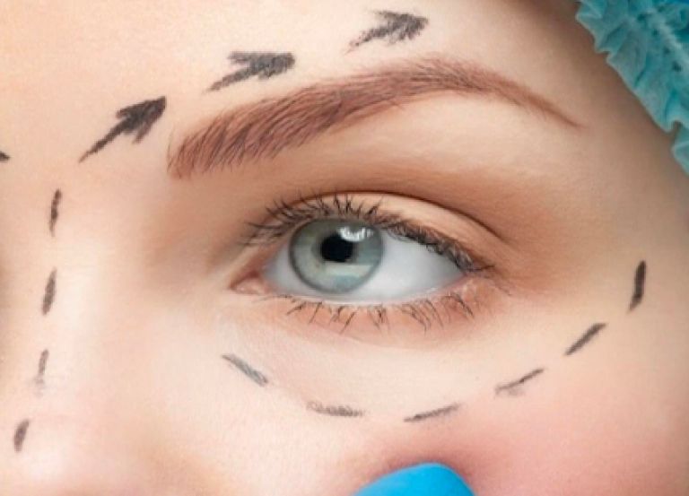 Göz Altı Torbaları Neden Olur?